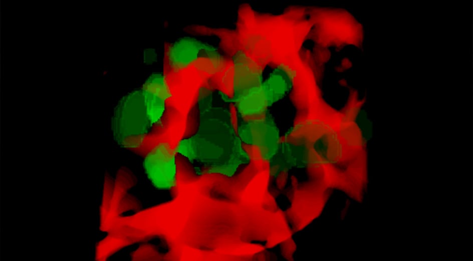 New-Model-Reveals-How-Cancer-Cells-Evade-and-Spread